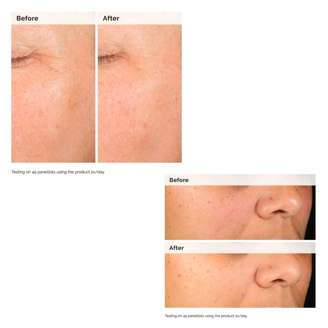 Alpha Arbutin 2% + HA Hiperpigmentation Serum