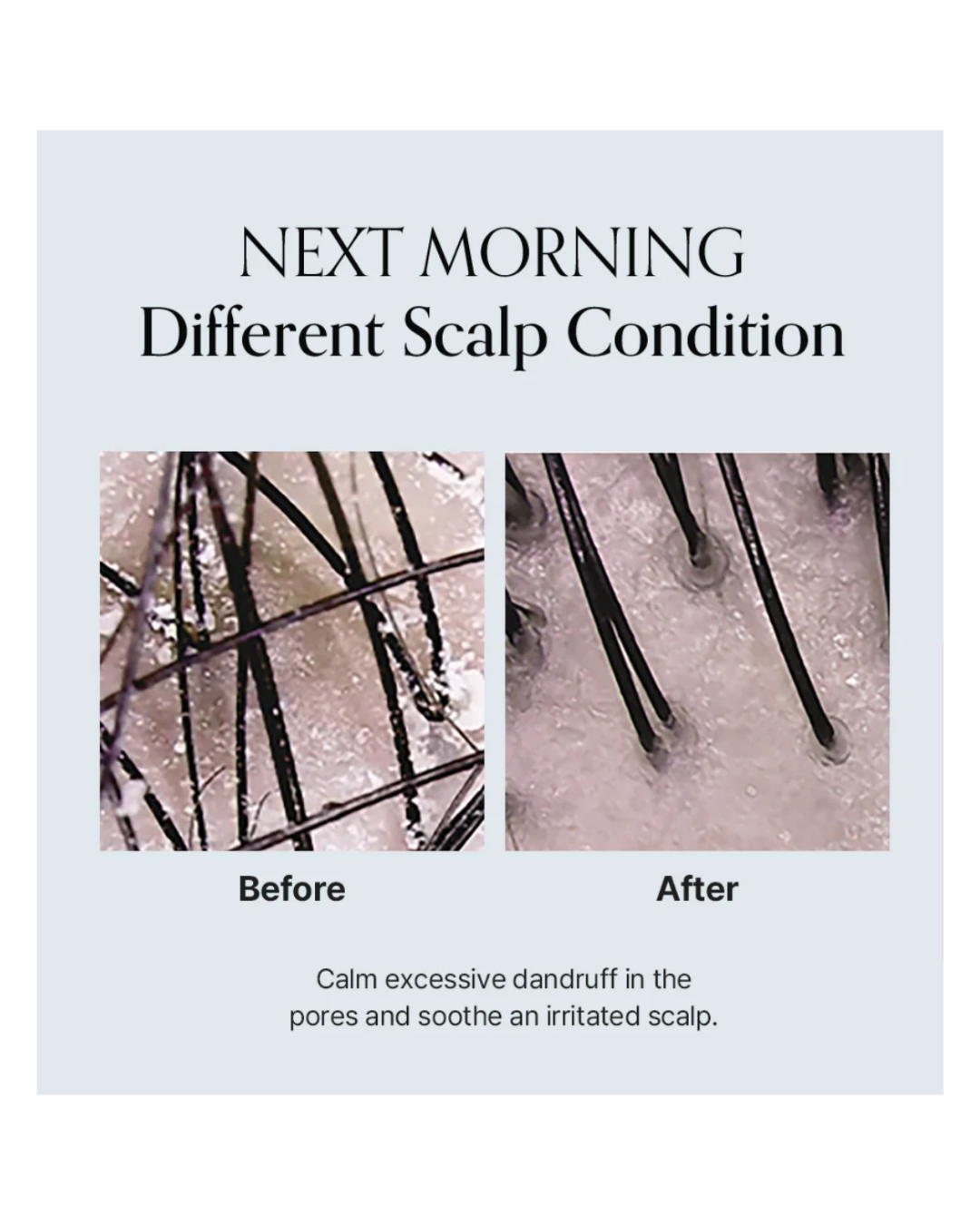 GROWUS Damage Therapy Scalp Scaling Ampoule