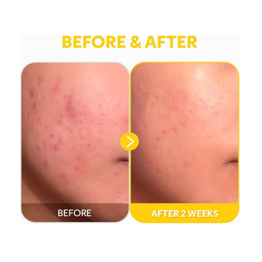 Tirtir Pure Vitamin C24 Serum