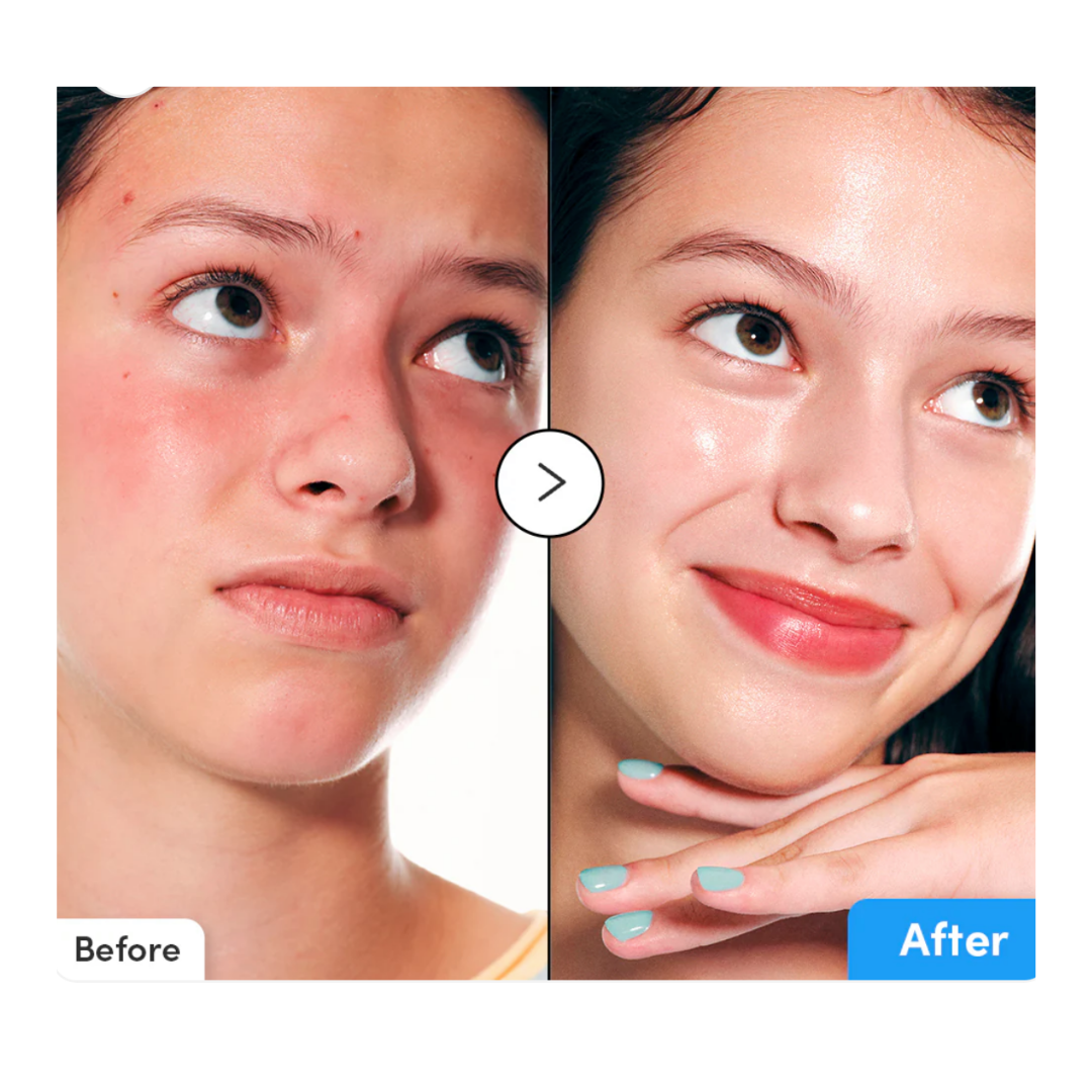 EQQUALBERRY Hyaltoin Flooding Serum